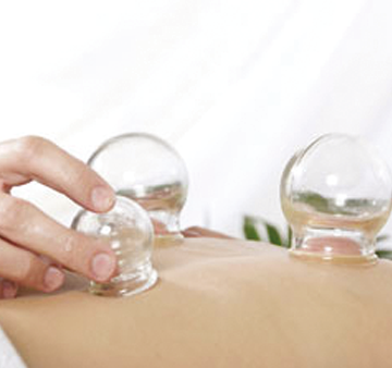 Sportmedizin Pecher - Schröpfen